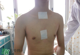 三九贴的贴法,三九贴的贴法视频