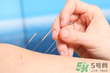 腰间盘突出针灸能治好吗?,腰间盘突出可以针灸吗有好处吗 腰间盘突出针灸能治好吗?,腰间盘突出可以针灸吗有好处吗