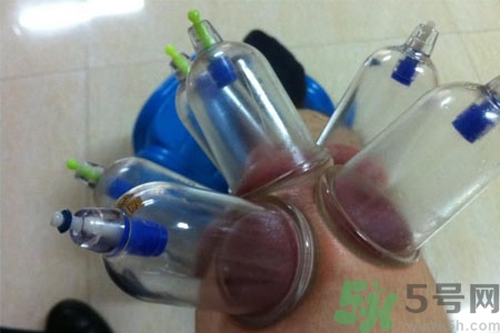 膝盖风湿可以拔罐吗,膝盖能拔罐吗?