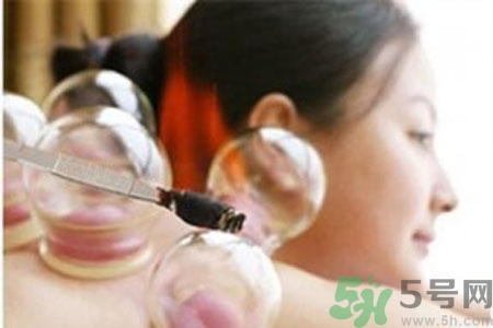 拔罐月经期间可以拔罐吗?,拔火罐会影响月经推迟月经吗