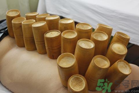 拔完火罐多久可以运动吗,拔火罐后能马上运动吗