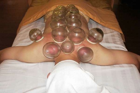 感冒了拨火罐有效吗,感冒拔火罐有用吗