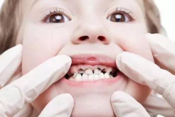 小孩换牙能吃鸡蛋吗,换牙齿能不能吃蛋