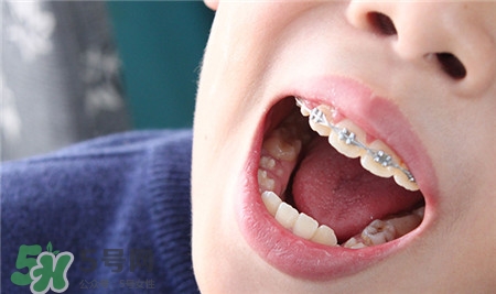 孩子换乳牙不掉可以自己拔吗,小孩换牙乳牙不掉怎么办