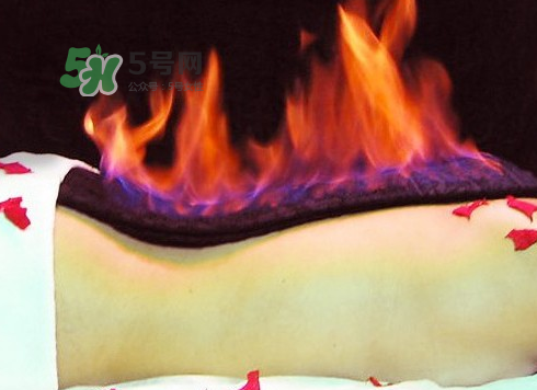 三伏天可以做火疗吗?,冬天可以做火疗吗