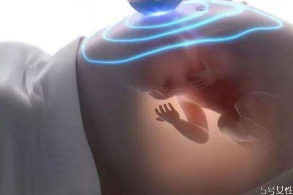 什么是羊膜带综合征,什么是羊膜带,有什么危害