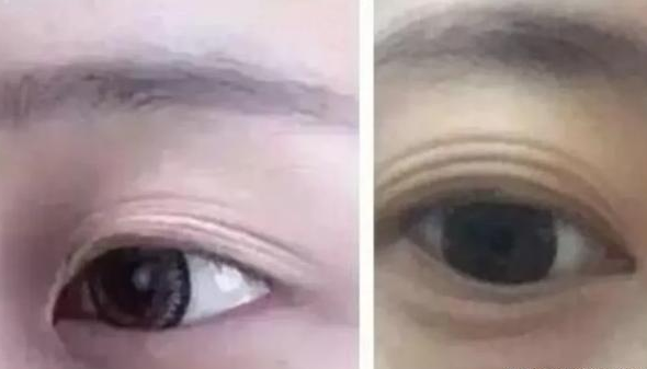 肾不好的人有什么表现,肾不好有什么表现症状有哪些