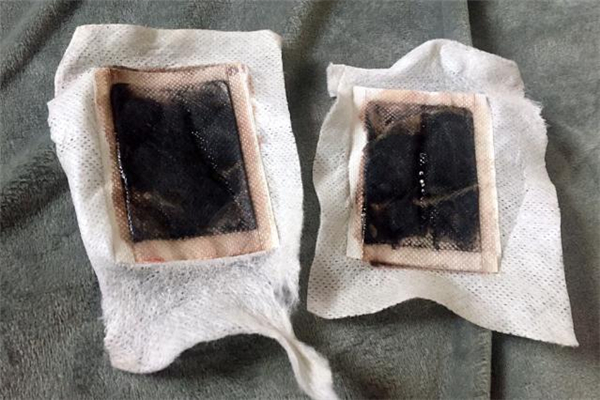 贴足贴脚底为什么出油真的祛湿吗?,贴足贴脚底为什么出油不黑 贴足贴脚底为什么出油真的祛湿吗?,贴足贴脚底为什么出油不黑