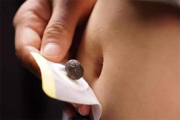 南怀瑾去湿气肚脐贴有用吗,南怀瑾肚脐贴排湿反应