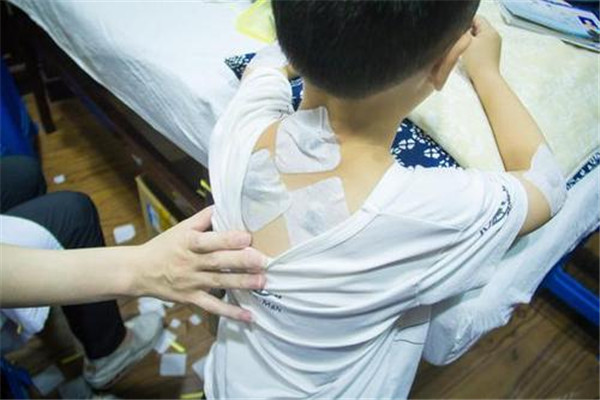 三伏贴有什么功效和作用,三伏贴的作用