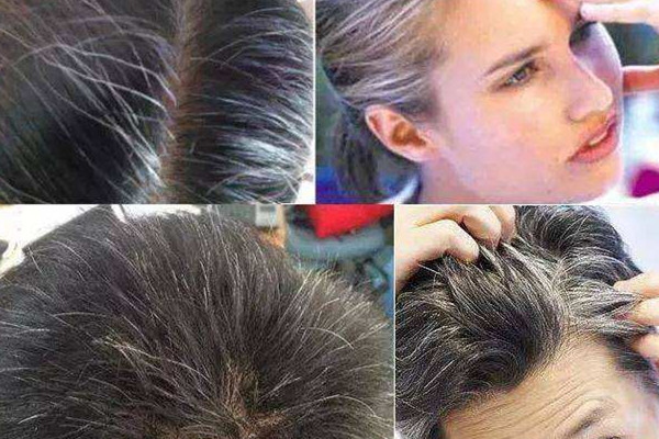 怎么才能变黑,头发白怎样能变黑