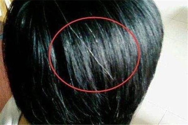 有白头发能拔吗,白头发能拔掉吗?