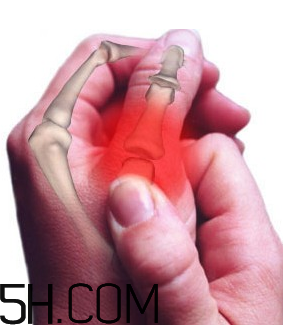 什么是关节疼痛,什么是关节疼痛的首发症状