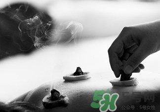 贴艾灸贴痒是怎么回事,艾灸贴时候有点痒是什么原因