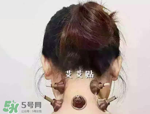 艾艾贴烟的走向判断病