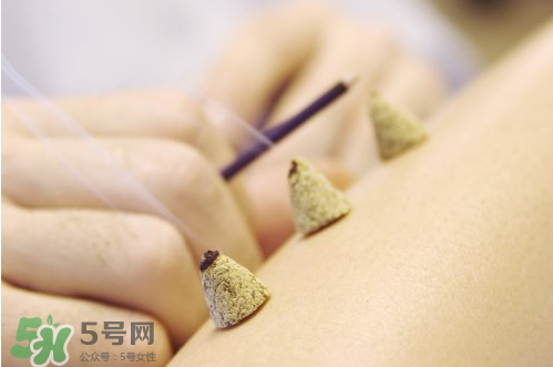 三伏灸和艾灸的区别,三伏艾灸的好处和功效有哪些 三伏灸和艾灸的区别,三伏艾灸的好处和功效有哪些