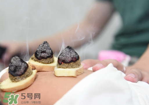 什么人适合做三伏灸,三伏灸是什么