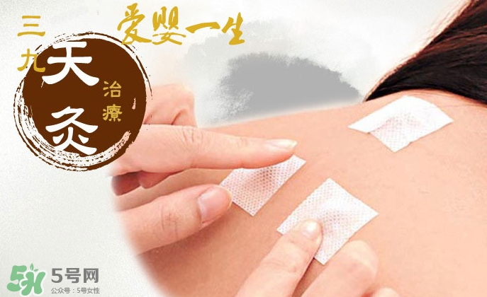 贴三伏贴挂什么科室,贴三伏贴挂什么科