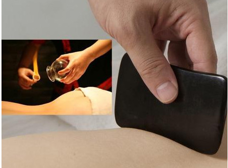 刮痧之后可以拔罐吗,刮痧后可以直接拔罐吗