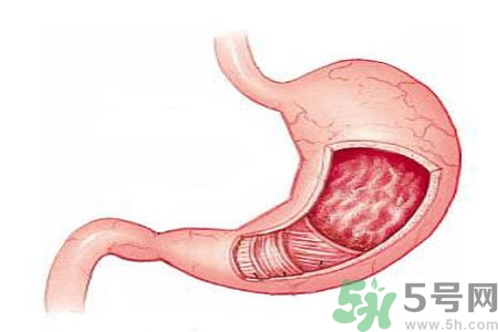 有什么方法可以缓解胃胀,如何缓解胃胀