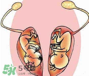 女人有双子宫是怎么回事,什么是双子宫,它有什么特点