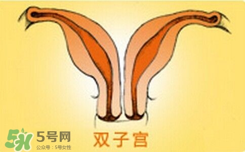 为什么会有两个子宫,为什么有的女人双子宫的 为什么会有两个子宫,为什么有的女人双子宫的