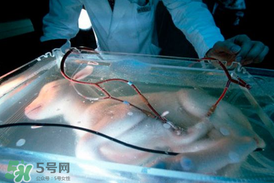 人造子宫生了5个案例,有人造子宫孕育孩子吗 人造子宫生了5个案例,有人造子宫孕育孩子吗