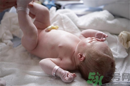 新生儿肚脐掉后怎么护理,新生儿肚脐什么时候掉正常 新生儿肚脐掉后怎么护理,新生儿肚脐什么时候掉正常