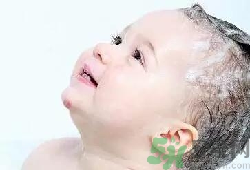 如何正确去除宝宝头垢(宝宝头垢怎样去除)