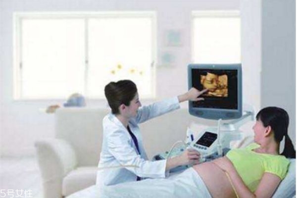 什么时候可以做四维彩超啊,孕妇什么时候做四维彩超最合适