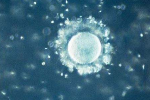 卵子稀少怎么办,卵子数量少怎么改善 卵子稀少怎么办,卵子数量少怎么改善