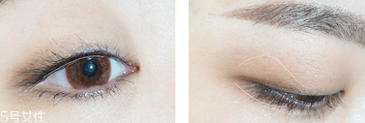 深层清洁的这些误区千万不要犯(深层清洁有用吗)