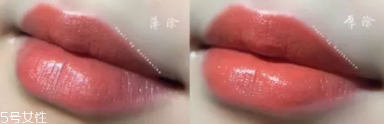 抬头纹手术多少钱(抬头纹做一下需要多少钱)