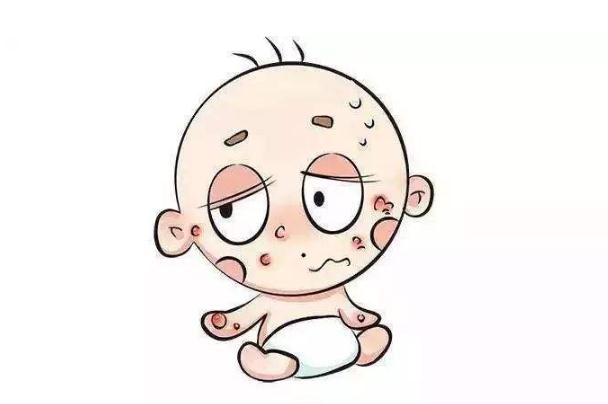 婴儿湿疹快速消退方法(婴儿湿疹快速消退方法马齿苋)