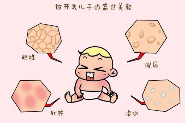 婴儿湿疹的预防(婴儿怎样预防湿疹)