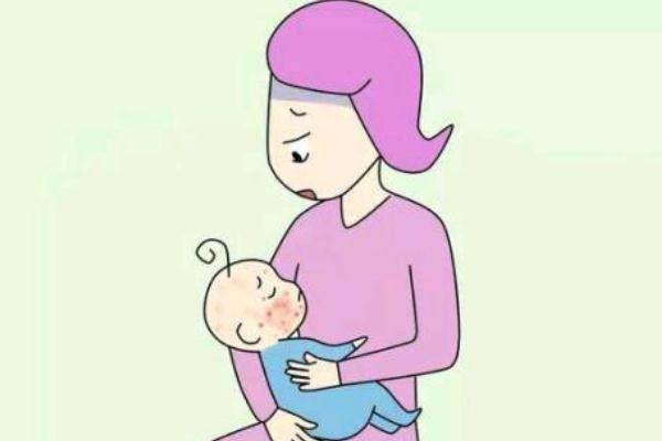 婴儿湿疹是胎毒吗(婴儿湿疹是胎毒吗)