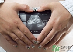 B超检查什么(b超检查什么啊) B超检查什么(b超检查什么啊)