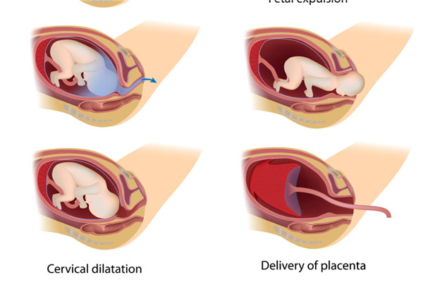 本次分娩顺序,分娩的过程有哪些阶段