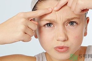 女性长痘痘是因为什么,女性长期长痘痘的原因