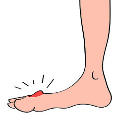 痛风究竟有多痛,痛风很痛吗?