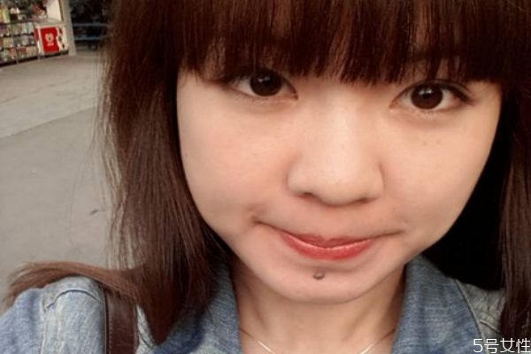 脸上长痣能去掉吗,脸上的痣可以去掉吗 有什么不好 脸上长痣能去掉吗,脸上的痣可以去掉吗 有什么不好