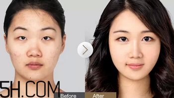 贴双眼皮有什么危害,双眼皮贴的危害性