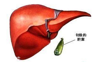 简述胆汁的生理功能,分泌和储存胆汁的结构 简述胆汁的生理功能,分泌和储存胆汁的结构