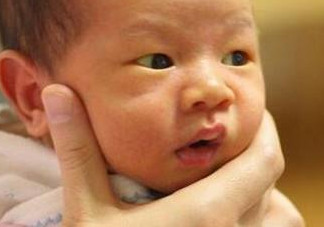 什么是新生儿黄疸,黄疸的原因,新生儿黄疸是怎么样的 什么是新生儿黄疸,黄疸的原因,新生儿黄疸是怎么样的