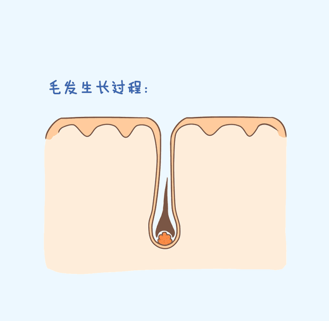 为什么会脱发严重该怎么办,女生为什么会脱发严重什么原因