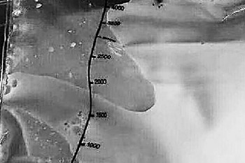 温州姑娘吃了一年外卖,抽出的血竟浮起一层油,温州姑娘吃外卖血变白色