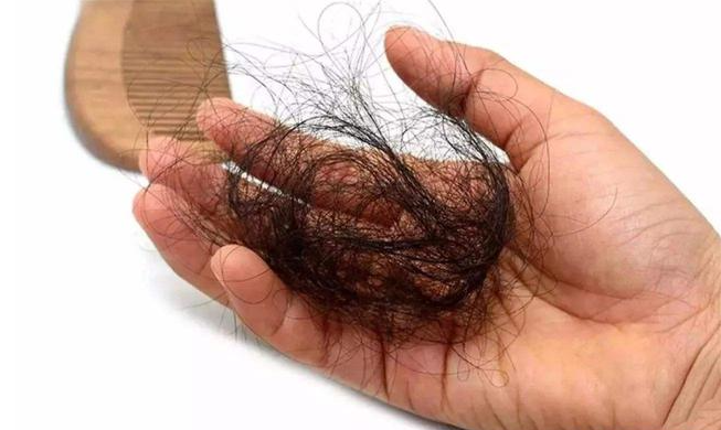 经常掉头发是缺什么营养吗,掉头发是身体缺什么维生素