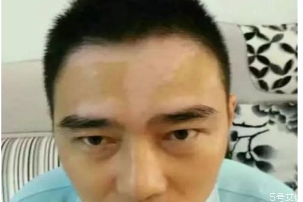 白癞风是怎么造成的?新军都真实,白癞风是怎么造成的?南京华夏建议