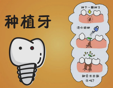 种植牙齿可以使用多少年,种牙保质期多少年