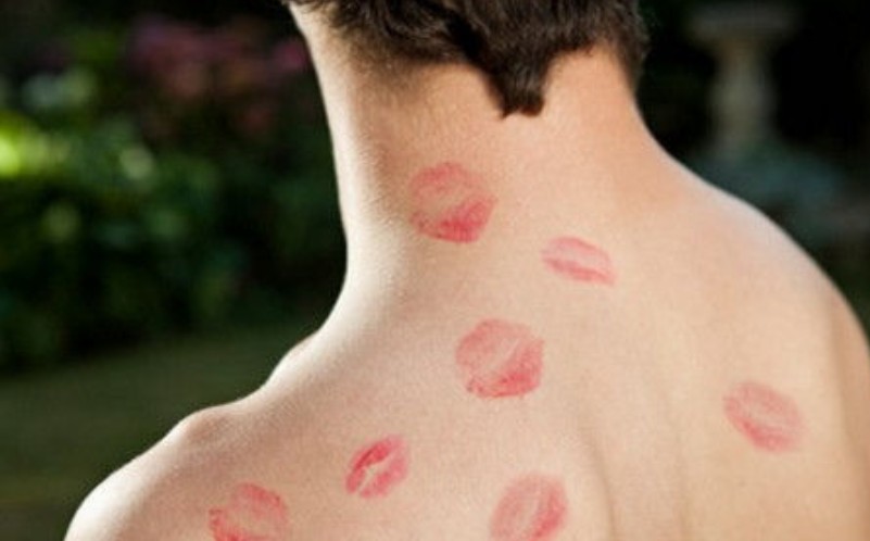 吻痕是热敷还是冷敷,吻痕到底是冷敷还是热敷 吻痕是热敷还是冷敷,吻痕到底是冷敷还是热敷